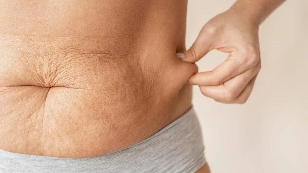 Cirurgia reparadora depois da bariátrica melhora saúde mental e confiança, aponta estudo